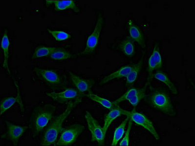Immunofluorescent analysis of Hela cells using AKR1A1 Antibody at dilution of 1:100 and Alexa Fluor 488-congugated AffiniPure Goat Anti-Rabbit IgG(H+L)Rabbit anti-Human AKR1A1 Polyclonal Antibody