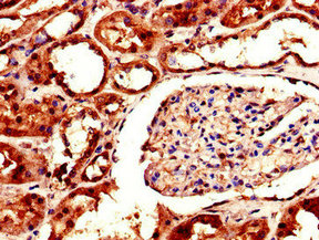 Immunohistochemistry of paraffin-embedded human kidney tissue using AKR1A1 Antibody at dilution of 1:100Rabbit anti-Human AKR1A1 Polyclonal Antibody