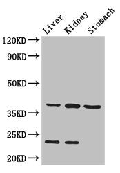 Western Blot | Positive WB detected in: Mouse liver tissue, Mouse kidney tissue, Mouse stomach tissue | All lanes: Akr1a1 antibody at 2.8μg/ml | Secondary | Goat polyclonal to rabbit IgG at 1/50000 dilution | Predicted band size: 37 kDa | Observed band size: 37, 23 kDaRabbit anti-Human AKR1A1 Polyclonal Antibody