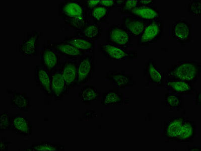 Immunofluorescent analysis of A549 cells using AKR1B1 Antibody at dilution of 1:100 and Alexa Fluor 488-congugated AffiniPure Goat Anti-Rabbit IgG(H+L)Rabbit anti-Human AKR1B1 Polyclonal Antibody