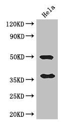 Western Blot | Positive WB detected in: Hela whole cell lysate | All lanes: AKR1B1 antibody at 3μg/ml | Secondary | Goat polyclonal to rabbit IgG at 1/50000 dilution | Predicted band size: 36 kDa | Observed band size: 36, 50 kDaRabbit anti-Human AKR1B1 Polyclonal Antibody