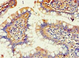 Immunohistochemistry of paraffin-embedded human small intestine tissue using AKR1B10 Antibody at dilution of 1:100Rabbit anti-Human AKR1B10 Polyclonal Antibody