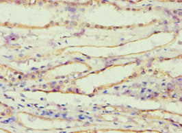Immunohistochemistry of paraffin-embedded human kidney tissue using AKR1B10 Antibody at dilution of 1:100Rabbit anti-Human AKR1B10 Polyclonal Antibody