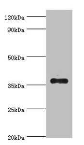 Western blot  | All lanes: AKR1B10 antibody at 4µg/ml + A549 whole cell lysate  | Secondary  | Goat polyclonal to rabbit IgG at 1/10000 dilution  | Predicted band size: 36 kDa  | Observed band size: 36 kDaRabbit anti-Human AKR1B10 Polyclonal Antibody