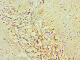 Immunohistochemistry of paraffin-embedded human gallbladder tissue using AKR1C3 Antibody at dilution of 1:100Rabbit anti-Human AKR1C3 Polyclonal Antibody