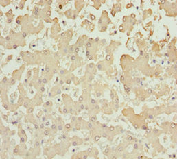 Immunohistochemistry of paraffin-embedded human liver tissue using AKR7A2 Antibody at dilution of 1:100Rabbit anti-Human AKR7A2 Polyclonal Antibody