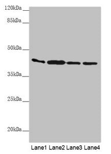 Western blot  | All lanes: AKR7A2 antibody at 0.88µg/ml  | Lane 1: Mouse small intestine tissue  | Lane 2: Mouse liver tissue  | Lane 3: Mouse gonadal tissue  | Lane 4: A431 whole cell lysate  | Secondary  | Goat polyclonal to rabbit IgG at 1/10000 dilution  | Predicted band size: 40 kDa  | Observed band size: 40 kDaRabbit anti-Human AKR7A2 Polyclonal Antibody