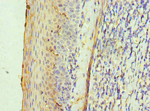 Immunohistochemistry of paraffin-embedded human tonsil tissue using ALAS2 Antibody at dilution of 1:100Rabbit anti-Human ALAS2 Polyclonal Antibody