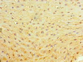 Immunohistochemistry of paraffin-embedded human esophagus tissue using ALAS2 Antibody at dilution of 1:100Rabbit anti-Human ALAS2 Polyclonal Antibody