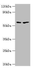 Western blot | All lanes: 5-aminolevulinate synthase, erythroid-specific, mitochondrial antibody at 7μg/ml | Lane 1: 293T whole cell lysate | Lane 2: Mouse brain tissue | Secondary | Goat polyclonal to rabbit IgG at 1/10000 dilution | Predicted band size: 65, 61, 50, 64 kDa | Observed band size: 65 kDaRabbit anti-Human ALAS2 Polyclonal Antibody