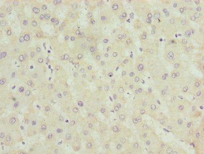 Immunohistochemistry of paraffin-embedded human liver tissue using ALAS2 Antibody at dilution of 1:100Rabbit anti-Human ALAS2 Polyclonal Antibody