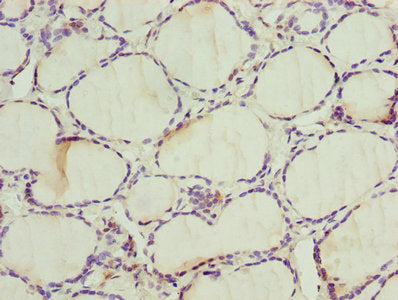 Immunohistochemistry of paraffin-embedded human thyroid tissue using ALAS2 Antibody at dilution of 1:100Rabbit anti-Human ALAS2 Polyclonal Antibody