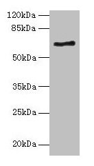 Western blot  | All lanes: ALAS2 antibody at 6µg/ml + K562 whole cell lysate  | Secondary  | Goat polyclonal to rabbit IgG at 1/10000 dilution  | Predicted band size: 65, 61, 50, 64 kDa  | Observed band size: 65 kDaRabbit anti-Human ALAS2 Polyclonal Antibody
