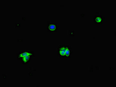 Immunofluorescent analysis of HepG2 cells using ALB Antibody at dilution of 1:100 and Alexa Fluor 488-congugated AffiniPure Goat Anti-Rabbit IgG(H+L)Rabbit anti-Human ALB Polyclonal Antibody