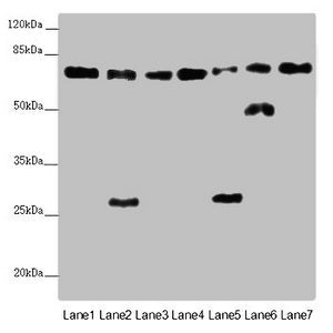 Western blot | All lanes: ALB antibody at 2 μg/ml | Lane 1: Mouse heart tissue | Lane 2: Mouse liver tissue | Lane 3: Mouse spleen tissue | Lane 4: Mouse lung tissue | Lane 5: Mouse kidney tissue | Lane 6: Mouse brain tissue | Lane 7: Mouse skeletal muscle tissue | Secondary | Goat polyclonal to rabbit IgG at 1/10000 dilution | Predicted band size: 70, 48, 46 kDa | Observed band size: 70, 50, 27 kDaRabbit anti-Human ALB Polyclonal Antibody
