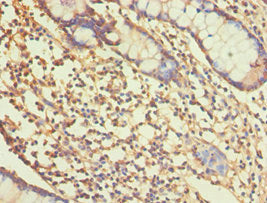 Immunohistochemistry of paraffin-embedded human small intestine tissue using ALDH1A1 Antibody at dilution of 1:100Rabbit anti-Human ALDH1A1 Polyclonal Antibody