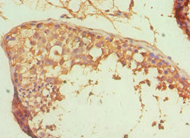Immunohistochemistry of paraffin-embedded human testis tissue using ALDH1A1 Antibody at dilution of 1:100Rabbit anti-Human ALDH1A1 Polyclonal Antibody