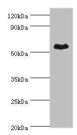 Western blot | All lanes: Retinal dehydrogenase 1 antibody at 4μg/ml + Mouse liver tissue | Secondary | Goat polyclonal to rabbit IgG at 1/10000 dilution | Predicted band size: 55 kDa | Observed band size: 55 kDaRabbit anti-Human ALDH1A1 Polyclonal Antibody