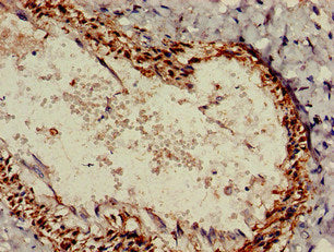 Immunohistochemistry of paraffin-embedded human lung tissue using ALDH1A2 Antibody at dilution of 1:100Rabbit anti-Human ALDH1A2 Polyclonal Antibody