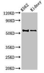 Western Blot  | Positive WB detected in: K562 whole cell lysate, Mouse kidney tissue  | All lanes: ALDH1A2 antibody at 3.5µg/ml  | Secondary  | Goat polyclonal to rabbit IgG at 1/50000 dilution  | Predicted band size: 57, 54, 55, 47 kDa  | Observed band size: 54 kDaRabbit anti-Human ALDH1A2 Polyclonal Antibody