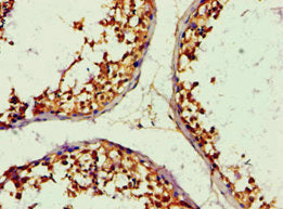 Immunohistochemistry of paraffin-embedded human testis tissue using ALDH1B1 Antibody at dilution of 1:100Rabbit anti-Human ALDH1B1 Polyclonal Antibody