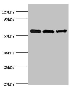 Western blot | All lanes: Aldehyde dehydrogenase X, mitochondrial antibody at 4μg/ml | Lane 1: Hela whole cell lysate | Lane 2: Rat brain tissue | Lane 3: HepG2 whole cell lysate | Secondary | Goat polyclonal to rabbit IgG at 1/10000 dilution | Predicted band size: 57 kDa | Observed band size: 57 kDaRabbit anti-Human ALDH1B1 Polyclonal Antibody