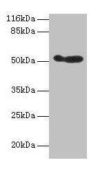 Western blot  | All lanes: ALDH3A1 antibody at 2µg/ml + 293T whole cell lysate  | Secondary  | Goat polyclonal to rabbit IgG at 1/10000 dilution  | Predicted band size: 51 kDa  | Observed band size: 51 kDaRabbit anti-Human ALDH3A1 Polyclonal Antibody