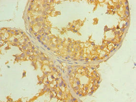 Immunohistochemistry of paraffin-embedded human testis tissue using ALDH4A1 Antibody at dilution of 1:100Rabbit anti-Human ALDH4A1 Polyclonal Antibody