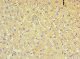 Immunohistochemistry of paraffin-embedded human liver tissue using ALDH4A1 Antibody at dilution of 1:100Rabbit anti-Human ALDH4A1 Polyclonal Antibody
