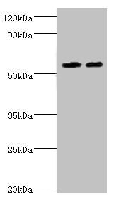 Western blot  | All lanes: ALDH4A1 antibody at 13µg/ml  | Lane 1: K562 whole cell lysate  | Lane 2: 293T whole cell lysate  | Secondary  | Goat polyclonal to rabbit IgG at 1/10000 dilution  | Predicted band size: 62, 56, 57 kDa  | Observed band size: 62 kDaRabbit anti-Human ALDH4A1 Polyclonal Antibody