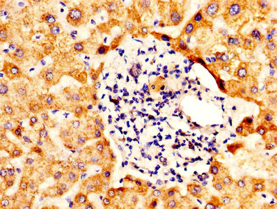 IHC image of ALDH5A1 Antibody diluted at 1:400 and staining in paraffin-embedded human liver tissue performed on a Leica BondTM system. After dewaxing and hydration, antigen retrieval was mediated by high pressure in a citrate buffer (pH 6.0). Section was blocked with 10% normal goat serum 30min at RT. Then primary antibody (1% BSA) was incubated at 4°C overnight. The primary is detected by a biotinylated secondary antibody and visualized using an HRP conjugated SP system.Rabbit anti-Human ALDH5A1 Polyclonal Antibody