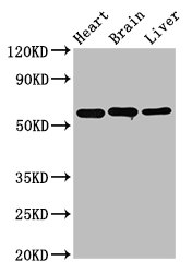 Western Blot  | Positive WB detected in: Rat heart tissue, Rat brain tissue, Mouse liver tissue  | All lanes: ALDH5A1 antibody at 3.2µg/ml  | Secondary  | Goat polyclonal to rabbit IgG at 1/50000 dilution  | Predicted band size: 58, 59 kDa  | Observed band size: 58 kDaRabbit anti-Human ALDH5A1 Polyclonal Antibody