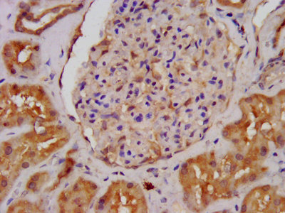 IHC image of ALDH7A1 Antibody diluted at 1:400 and staining in paraffin-embedded human kidney tissue performed on a Leica BondTM system. After dewaxing and hydration, antigen retrieval was mediated by high pressure in a citrate buffer (pH 6.0). Section was blocked with 10% normal goat serum 30min at RT. Then primary antibody (1% BSA) was incubated at 4°C overnight. The primary is detected by a biotinylated secondary antibody and visualized using an HRP conjugated SP system.Rabbit anti-Human ALDH7A1 Polyclonal Antibody