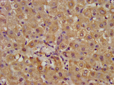 IHC image of ALDH7A1 Antibody diluted at 1:400 and staining in paraffin-embedded human liver tissue performed on a Leica BondTM system. After dewaxing and hydration, antigen retrieval was mediated by high pressure in a citrate buffer (pH 6.0). Section was blocked with 10% normal goat serum 30min at RT. Then primary antibody (1% BSA) was incubated at 4°C overnight. The primary is detected by a biotinylated secondary antibody and visualized using an HRP conjugated SP system.Rabbit anti-Human ALDH7A1 Polyclonal Antibody