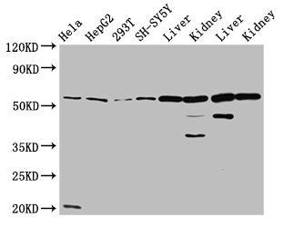 Western Blot  | Positive WB detected in: Hela whole cell lysate, HepG2 whole cell lysate, 293T whole cell lysate, SH-SY5Y whole cell lysate, Rat liver tissue, Rat kidney tissue, Mouse liver tissue, Mouse kidney tissue  | All lanes: ALDH7A1 antibody at 4.7µg/ml  | Secondary  | Goat polyclonal to rabbit IgG at 1/50000 dilution  | Predicted band size: 59, 56, 52 kDa  | Observed band size: 59 kDaRabbit anti-Human ALDH7A1 Polyclonal Antibody