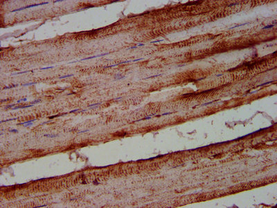 IHC image of ALOX12 Antibody diluted at 1:500 and staining in paraffin-embedded human skeletal muscle tissue performed on a Leica BondTM system. After dewaxing and hydration, antigen retrieval was mediated by high pressure in a citrate buffer (pH 6.0). Section was blocked with 10% normal goat serum 30min at RT. Then primary antibody (1% BSA) was incubated at 4°C overnight. The primary is detected by a biotinylated secondary antibody and visualized using an HRP conjugated SP system.Rabbit anti-Human ALOX12 Polyclonal Antibody