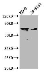 Western Blot  | Positive WB detected in: K562 whole cell lysate, SH-SY5Y whole cell lysate  | All lanes: ALOX12 antibody at 3.53µg/ml  | Secondary  | Goat polyclonal to rabbit IgG at 1/50000 dilution  | Predicted band size: 76 kDa  | Observed band size: 76 kDaRabbit anti-Human ALOX12 Polyclonal Antibody