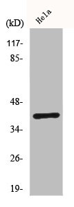 Western Blot analysis of Hela cells using ChemR23 Polyclonal AntibodyRabbit anti-Human CMKLR1 Polyclonal Antibody