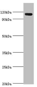 Western blot | All lanes: Angiomotin antibody at 2μg/ml + 293T whole cell lysate | Secondary | Goat polyclonal to rabbit IgG at 1/10000 dilution | Predicted band size: 119, 73 kDa | Observed band size: 119 kDaRabbit anti-Human AMOT Polyclonal Antibody