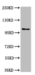 Western Blot  | Positive WB detected in: U87 whole cell lysate  | All lanes: AMPD2 antibody at 3µg/ml  | Secondary  | Goat polyclonal to rabbit IgG at 1/50000 dilution  | Predicted band size: 101, 93, 89 kDa  | Observed band size: 101 kDaRabbit anti-Human AMPD2 Polyclonal Antibody