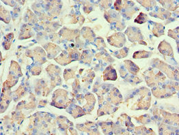 Immunohistochemistry of paraffin-embedded human pancreatic tissue using AMY2A Antibody at dilution of 1:100Rabbit anti-Human AMY2A Polyclonal Antibody