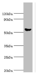 Western blot | All lanes: Pancreatic alpha-amylase antibody at 6μg/ml + Mouse liver tissue | Secondary | Goat polyclonal to rabbit IgG at 1/10000 dilution | Predicted band size: 58, 31 kDa | Observed band size: 58 kDaRabbit anti-Human AMY2A Polyclonal Antibody