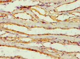 Immunohistochemistry of paraffin-embedded human kidney tissue using AMY2B Antibody at dilution of 1:100Rabbit anti-Human AMY2B Polyclonal Antibody