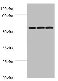 Western blot | All lanes: Alpha-amylase 2B antibody at 8μg/ml | Lane 1: Mouse skeletal muscle tissue | Lane 2: HL60 whole cell lysate | Lane 3: K562 whole cell lysate | Secondary | Goat polyclonal to rabbit IgG at 1/10000 dilution | Predicted band size: 58, 43 kDa | Observed band size: 58 kDaRabbit anti-Human AMY2B Polyclonal Antibody