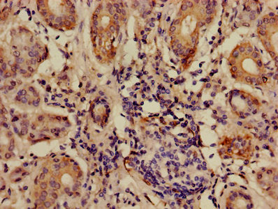 Immunohistochemistry of paraffin-embedded human salivary gland tissue using ANGPTL7 Antibody at dilution of 1:100Rabbit anti-Human ANGPTL7 Polyclonal Antibody
