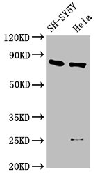 Western Blot  | Positive WB detected in: SH-SY5Y whole cell lysate, Hela whole cell lysate  | All lanes: CTNNB1 antibody at 2.5µg/ml  | Secondary  | Goat polyclonal to rabbit IgG at 1/50000 dilution  | Predicted band size: 86 kDa  | Observed band size: 86 kDaRabbit anti-Human CTNNB1 Polyclonal Antibody
