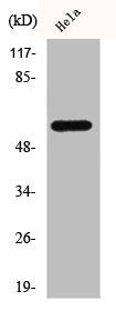 Western Blot analysis of HeLa cells using c-Src Polyclonal AntibodyRabbit anti-Human SRC Polyclonal Antibody