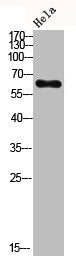 Western Blot analysis of hela using c-Src Polyclonal Antibody.Rabbit anti-Human SRC Polyclonal Antibody