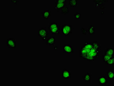 Immunofluorescent analysis of MCF-7 cells using ANP32A Antibody at dilution of 1:100 and Alexa Fluor 488-congugated AffiniPure Goat Anti-Rabbit IgG(H+L)Rabbit anti-Human ANP32A Polyclonal Antibody
