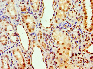 Immunohistochemistry of paraffin-embedded human kidney tissue using the antibody at dilution of 1:100Rabbit anti-Human ANP32A Polyclonal Antibody